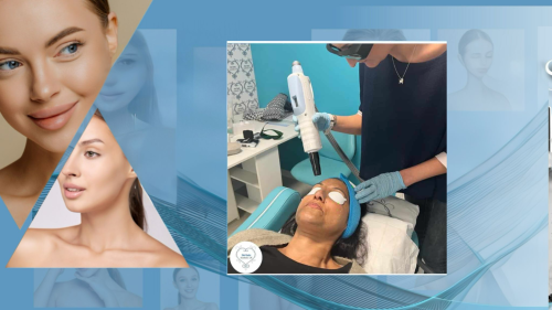 Carbon Laser Peel Training