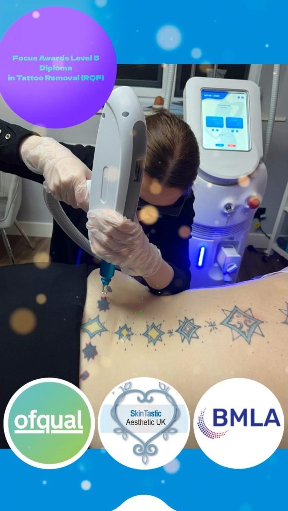 Laser Tattoo Removal, Level 5 Certificate in Laser Tattoo Removal,
