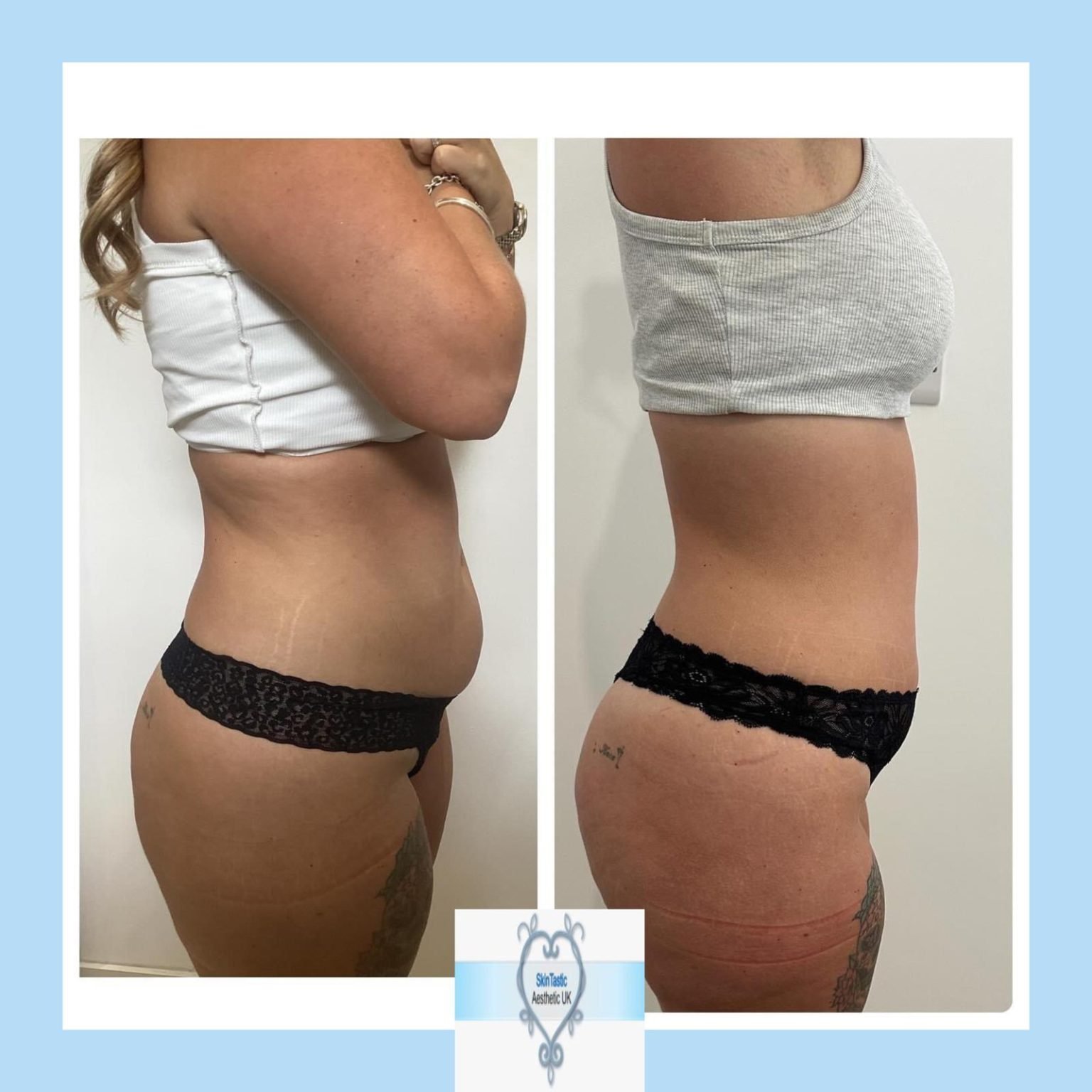 PHOTO-2025-03-29-19-44-07