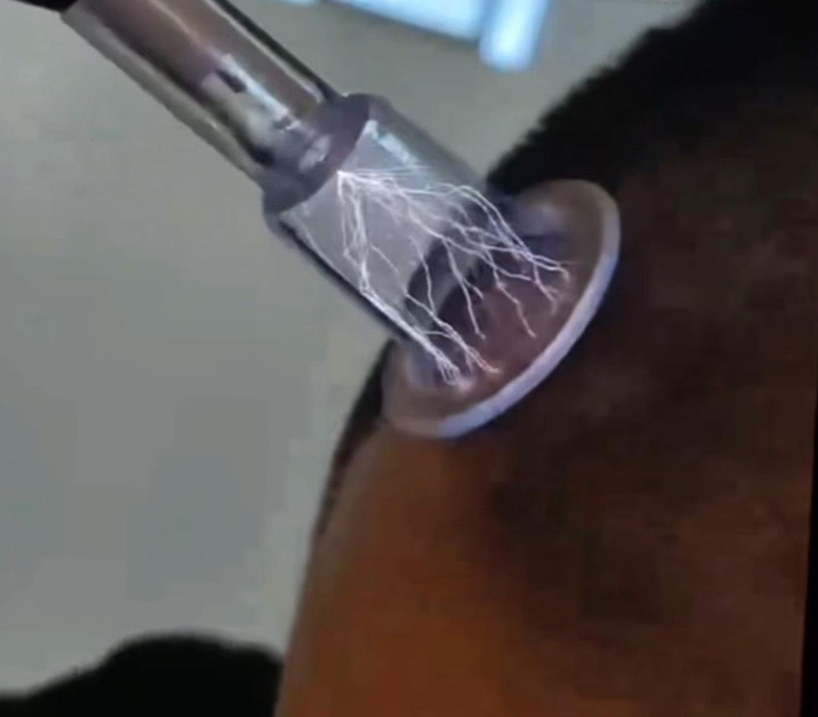 SkinCool+ – Dual Function Cold & Thermal Plasma System - Image 11