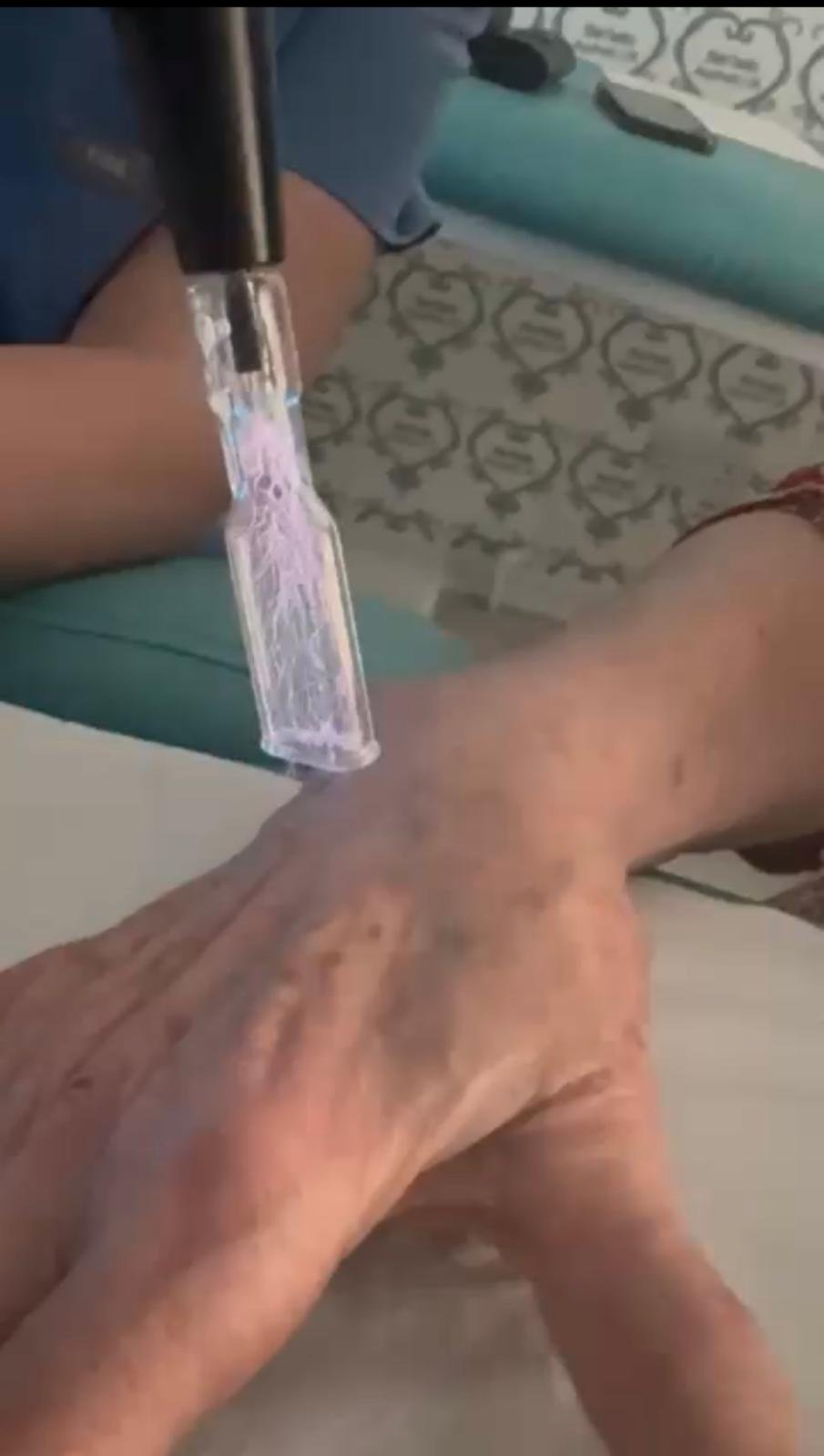 SkinCool+ – Dual Function Cold & Thermal Plasma System - Image 15