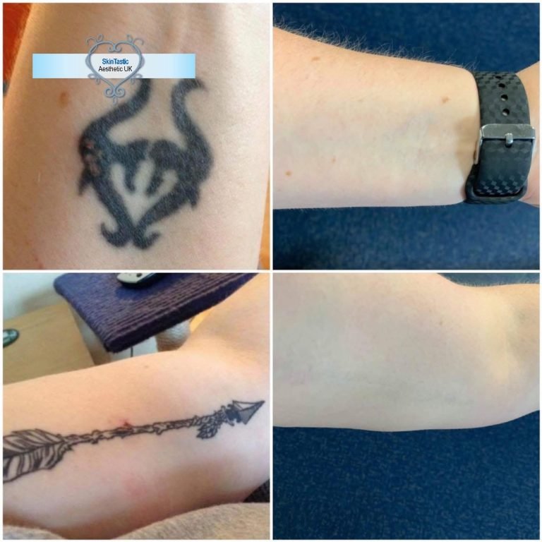 90B2E579-A66E-4926-902E-B7897320A00E