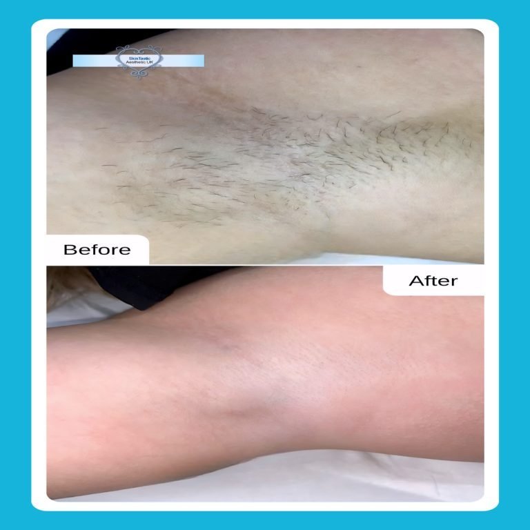 D742424A-D9A9-4D4D-90BA-0C1CD83D7676 (1)