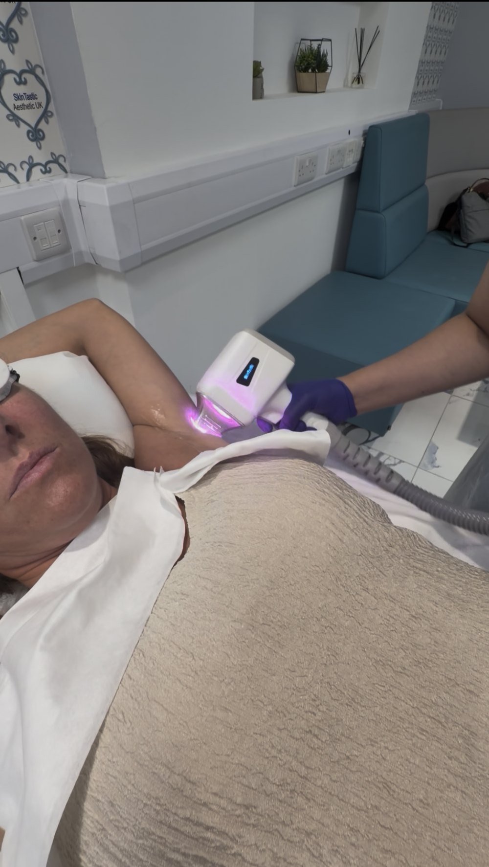 The DPL4 diode handpiece in use on an underarm treatment at the Skintastic clinic