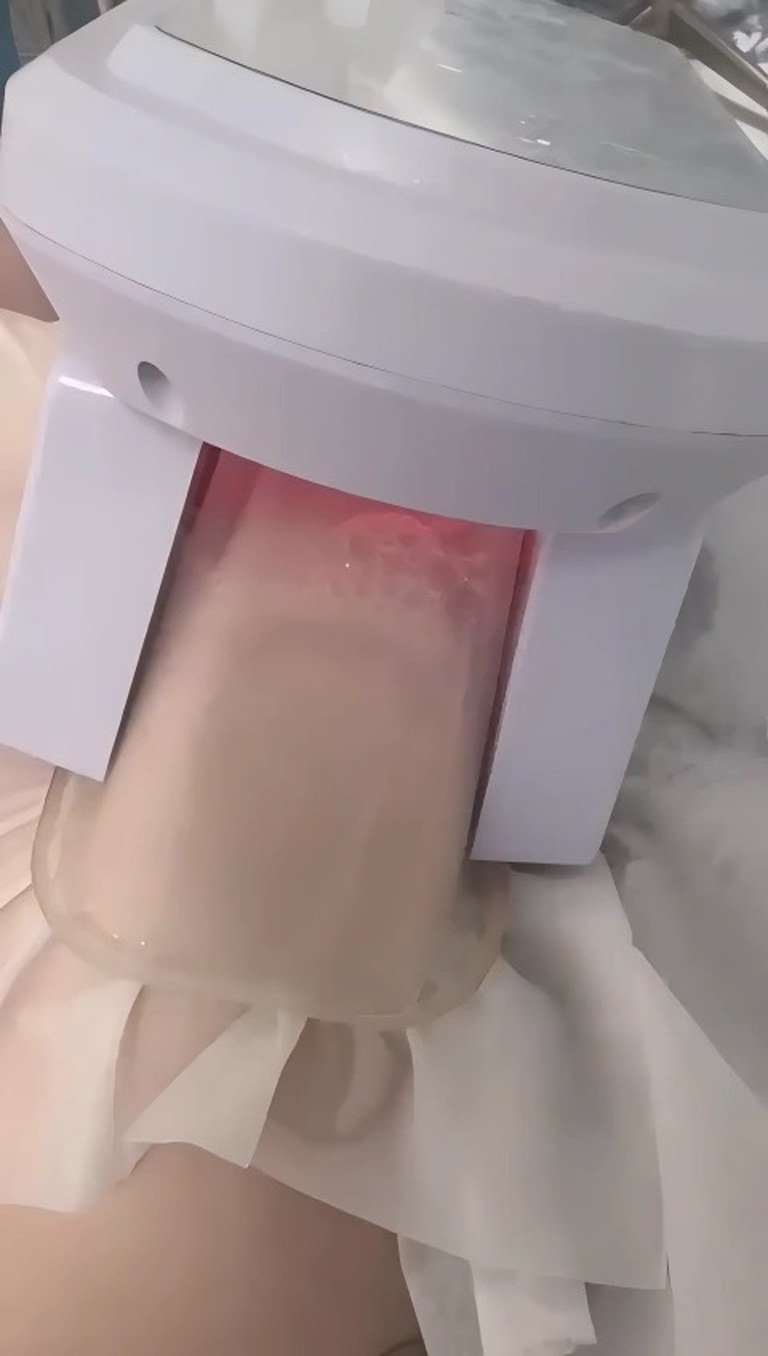Fat freezing applicator in place on the abdomen
