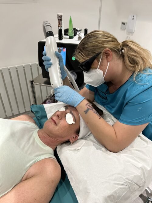 Laser facial treatment being carried out in the Skintastic training clinic