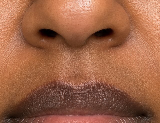 Example of lip hyperpigmentation: a darker outer lip border against a lighter inner lip, on brown skin