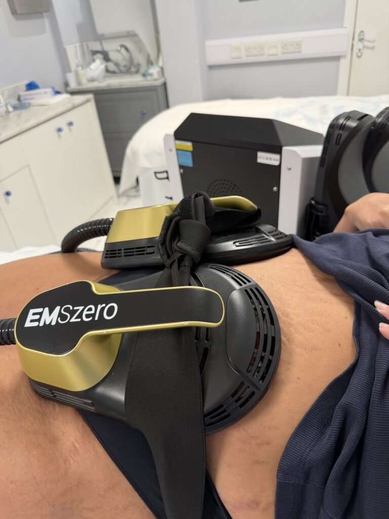 EMSzero applicators strapped in position over the abdomen during an EMS muscle sculpting treatment