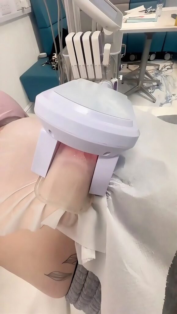 Fat freezing cryolipolysis treatment being applied to a client's thigh at Skintastic Aesthetics