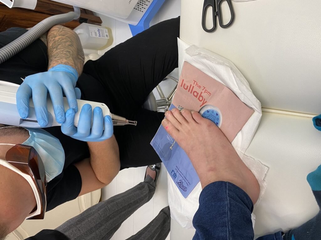 Fungal nail laser treatment being carried out on a client's toenail