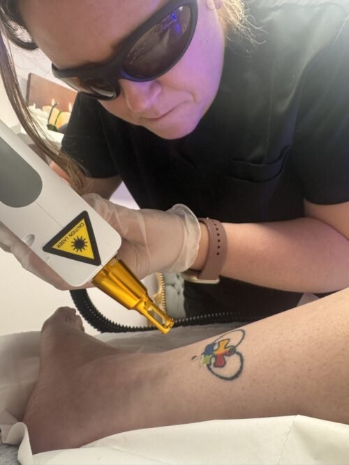 Practitioner in laser safety eyewear treating a small colour tattoo with a Q-switched handpiece at the Skintastic Southampton academy