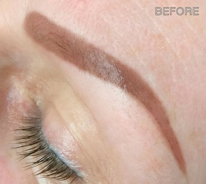 Semi-permanent makeup brow before laser removal