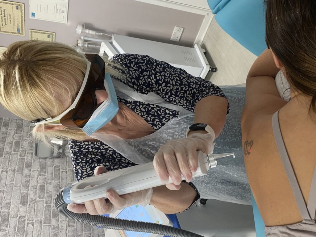 Laser tattoo removal Level 5 training being carried out on a client's back