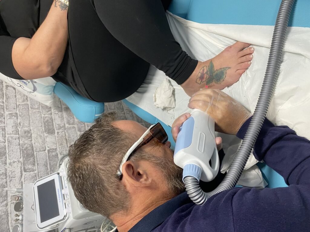 Laser tattoo removal Level 5 training being carried out on a client's foot tattoo