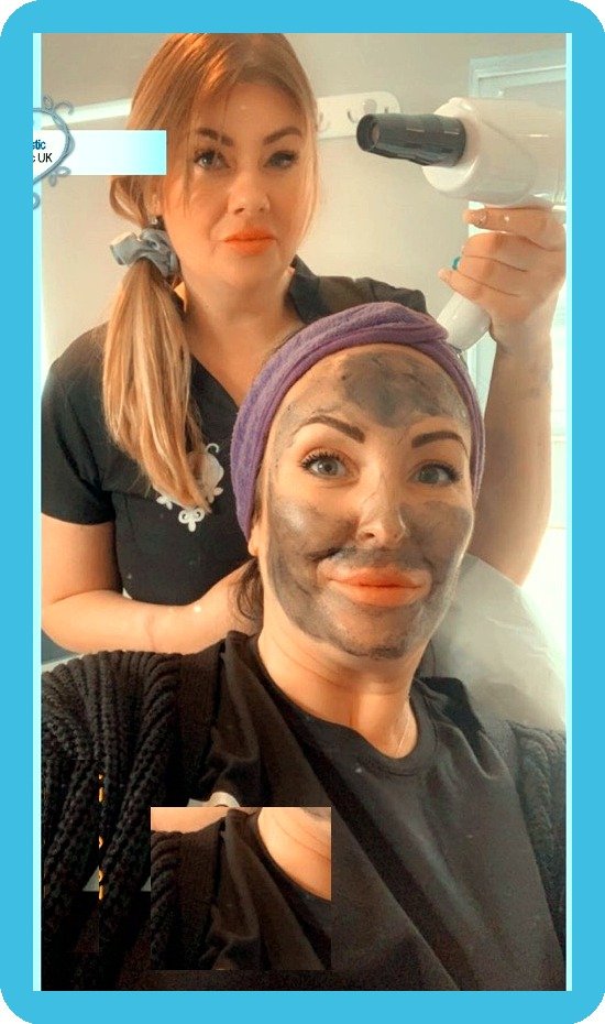 Carla performing a carbon laser facial at Skintastic Aesthetics Southampton
